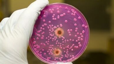 Pathological release from men when he is excited